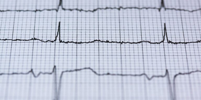 Electronic Health Records: A Prognosis for Severe Missteps and Potential Fraud 5 Selective Focus Photography of White and Black Vital Sign Printing Paper, indicating electronic health records